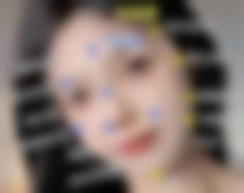 五、凹进去的红色疤痕手术治疗法