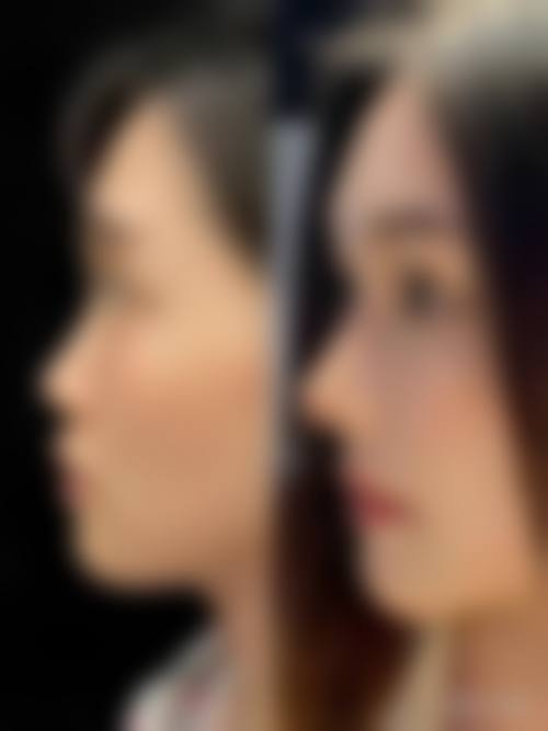 四、保定现代妇产医院整形美容中 心特色项目