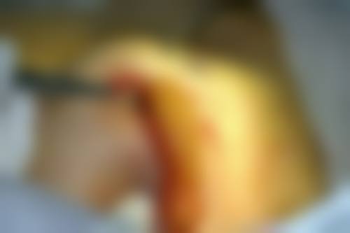 八、新时代整形美容医院真实的患者评价