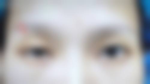 临床实例分享