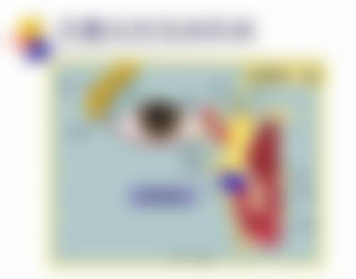临床实例分享:吴秀娟医生的成功实践