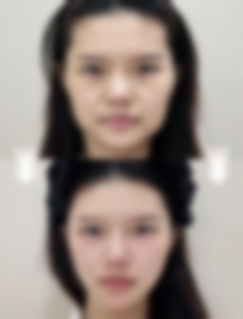 九、潍坊妍美医疗美容诊所真实的患者评价
