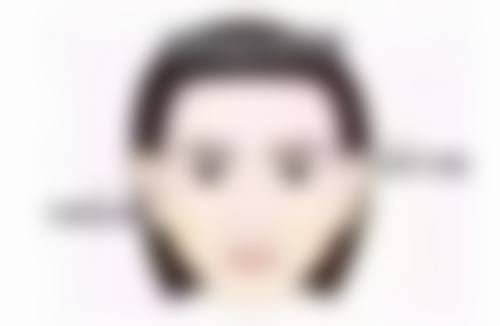 丰太阳穴手术有什么危险?感染、血管神经受损等风险确实不容忽视!