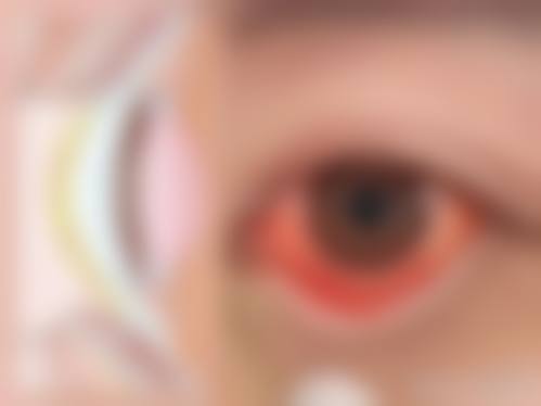临床实例分享