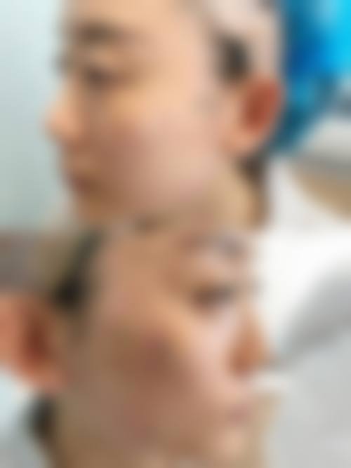 FAQ:常见问题解答
