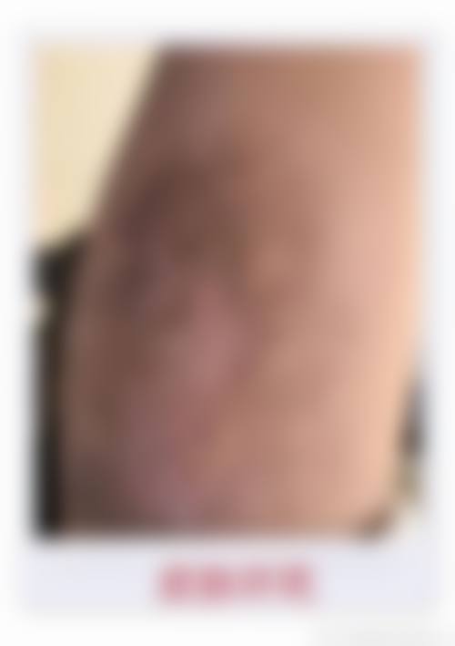 三、天津欧非整形医院美容诊疗项目有哪些?