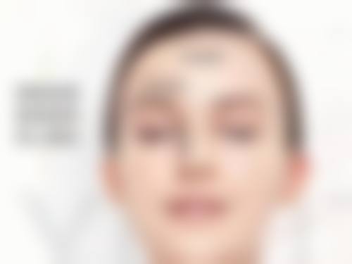 二、眼部疲劳与从双眼皮变成单眼皮