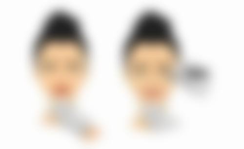 三、几岁能割双眼皮吗?手术前的准备工作