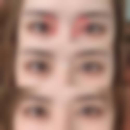四、蚌埠华美整形美容医院特色项目