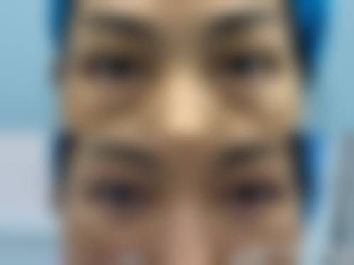 患者真实评价:选择鄢潮海医生是一种什么体验
