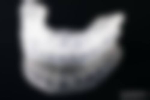 优惠活动详情:价格透明与限时补贴