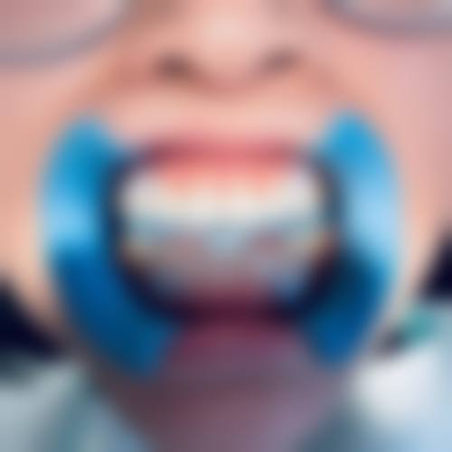 优惠活动详情