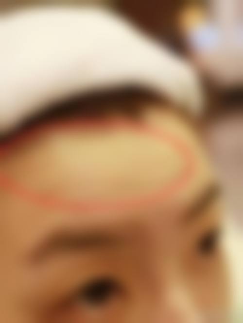 预约鄢潮海医生:专属优惠活动详情