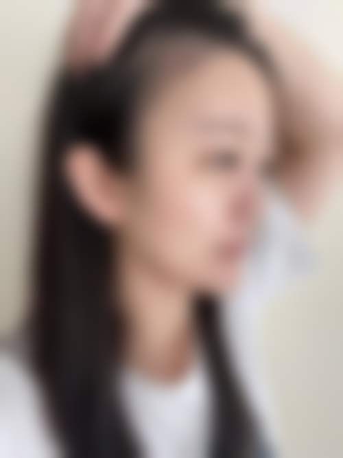 扬州俏华美医疗美容诊所高军飞排名第几位？最新榜单揭晓！眼鼻精雕真实口碑解析