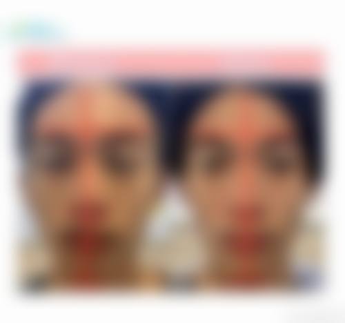 四、东港东英医疗美容诊所特色项目