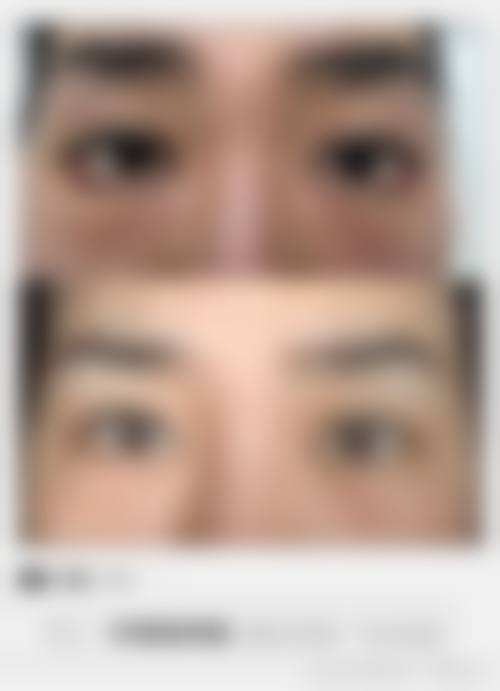 总结:选择正规机构,安心变得更美是关键