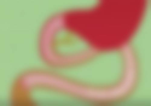五、双眼皮拆线后几天能沾水之沾水时间的确定