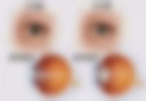 FAQ 济南新视界眼科医院 丁玉龙医生
