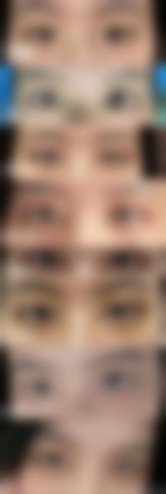四、深圳市皇佳翼整形美容医院特色项目
