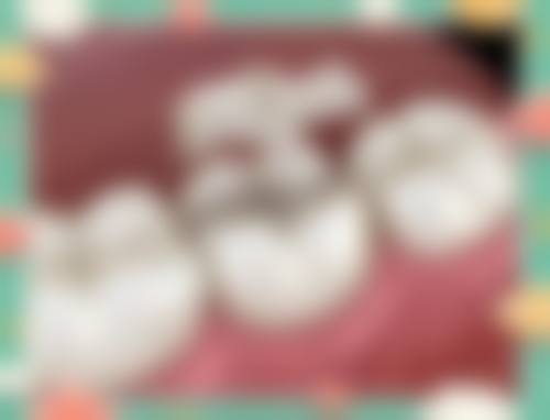 结语:专精口腔团队助您重获自信笑容