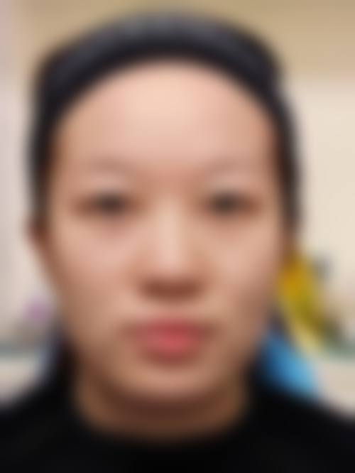 四、金华婷如韵整形医院特色项目