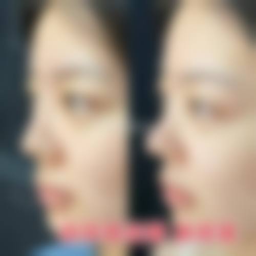 河北石家庄元氏鑫颜医疗美容真实的患者评价