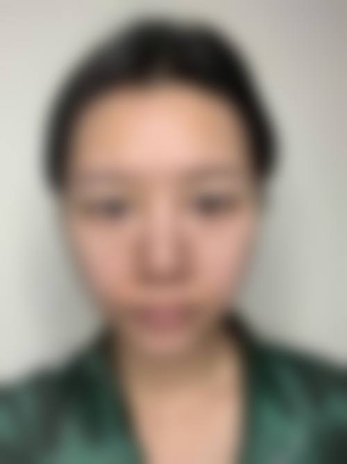 六、深圳皓妍整形医院价格表
