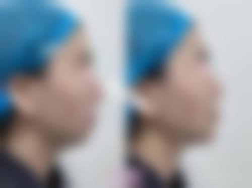 三、深圳皓妍整形医院诊疗项目有哪些?