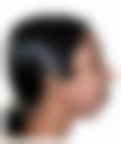 服务流程与患者保护:从预约到术后随访全程贴心