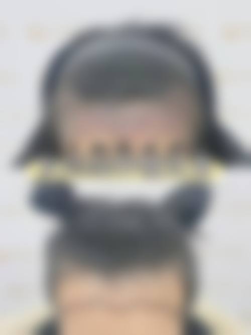服务流程与患者保护:从询问到术后全程管理