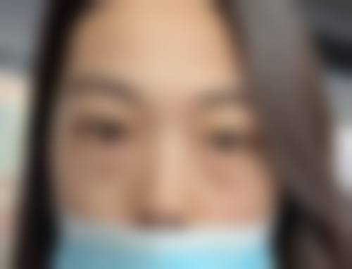 九、武汉爱美仕整形医院真实的患者评价