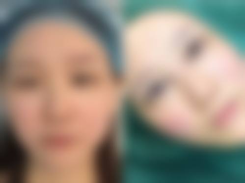 八、重庆开州薇雅医疗美容门诊部真实的患者评价