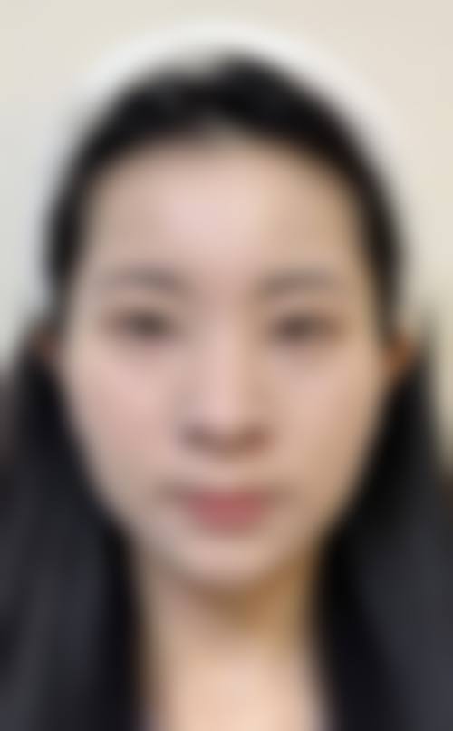 优惠活动详情