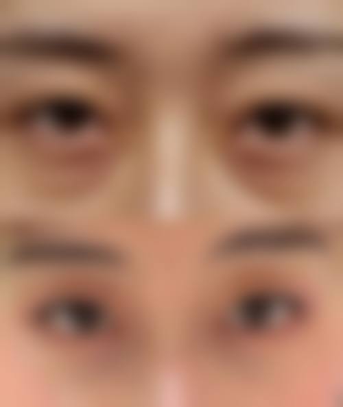 四、沈阳L.K利百加整形美容医院特色项目