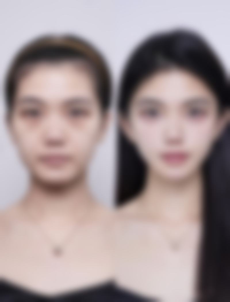 一、认识眼纹眼袋特别重度的成因