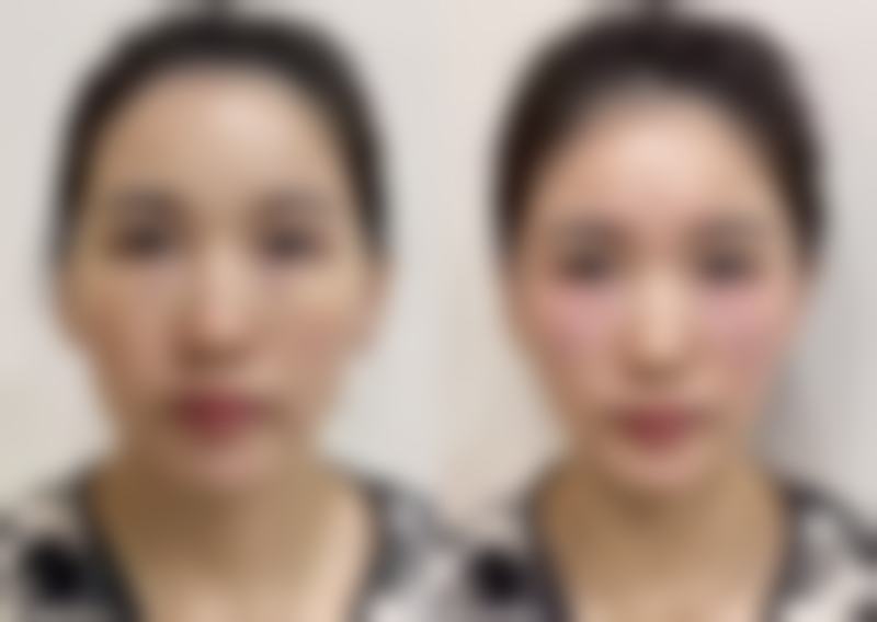 临床实例分享
