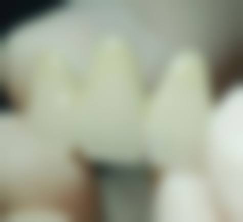 优惠活动与透明价格