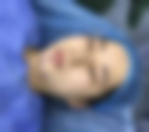三、濮阳肌愈整形医院诊疗项目有哪些?