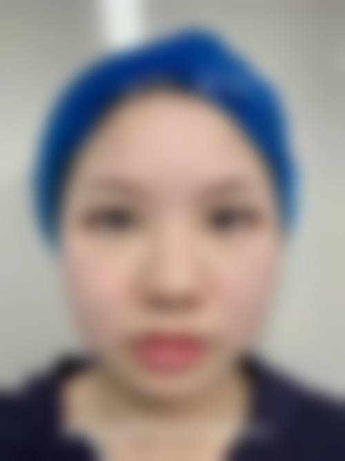 九、郑州缔莱美整形医院真实的患者评价