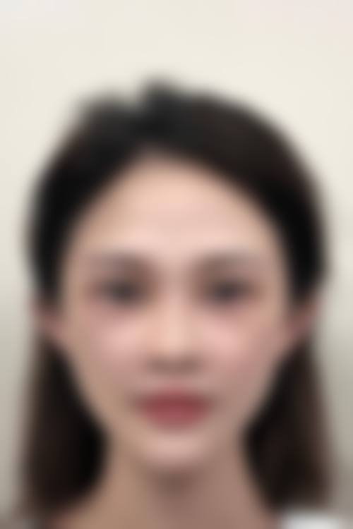 八、兴义刘德欣医疗美容诊所真实的患者评价