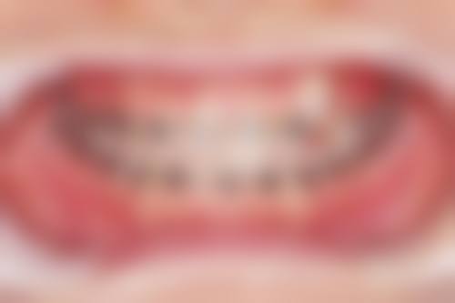 FAQ:常见问题解答