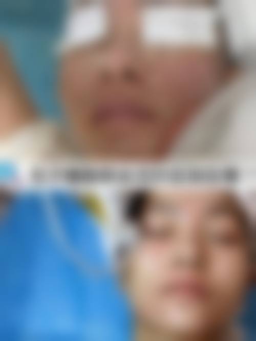 三、尹成焕技术优势