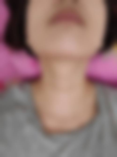 服务流程:从术前到术后的全周期管家式服务
