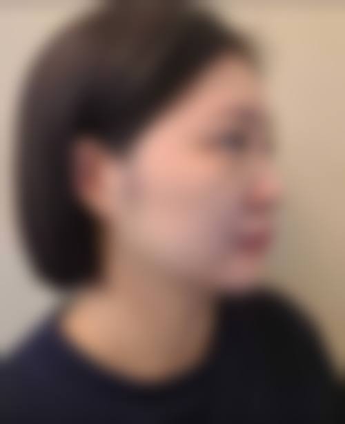 九、南宁橙之美医疗美容真实的患者评价
