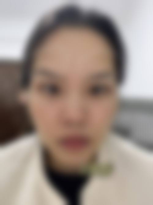 五、临海熙妍整形医院价格表