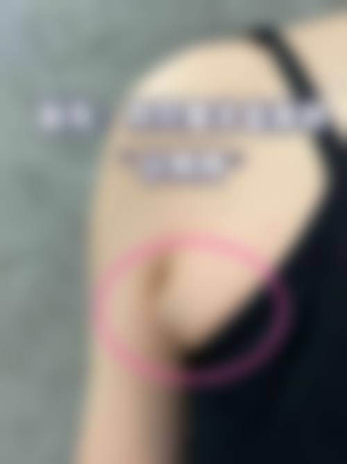 四、深圳鹏辉整形医院特色项目
