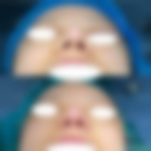 八、南宁橙之美医疗美容预约方式