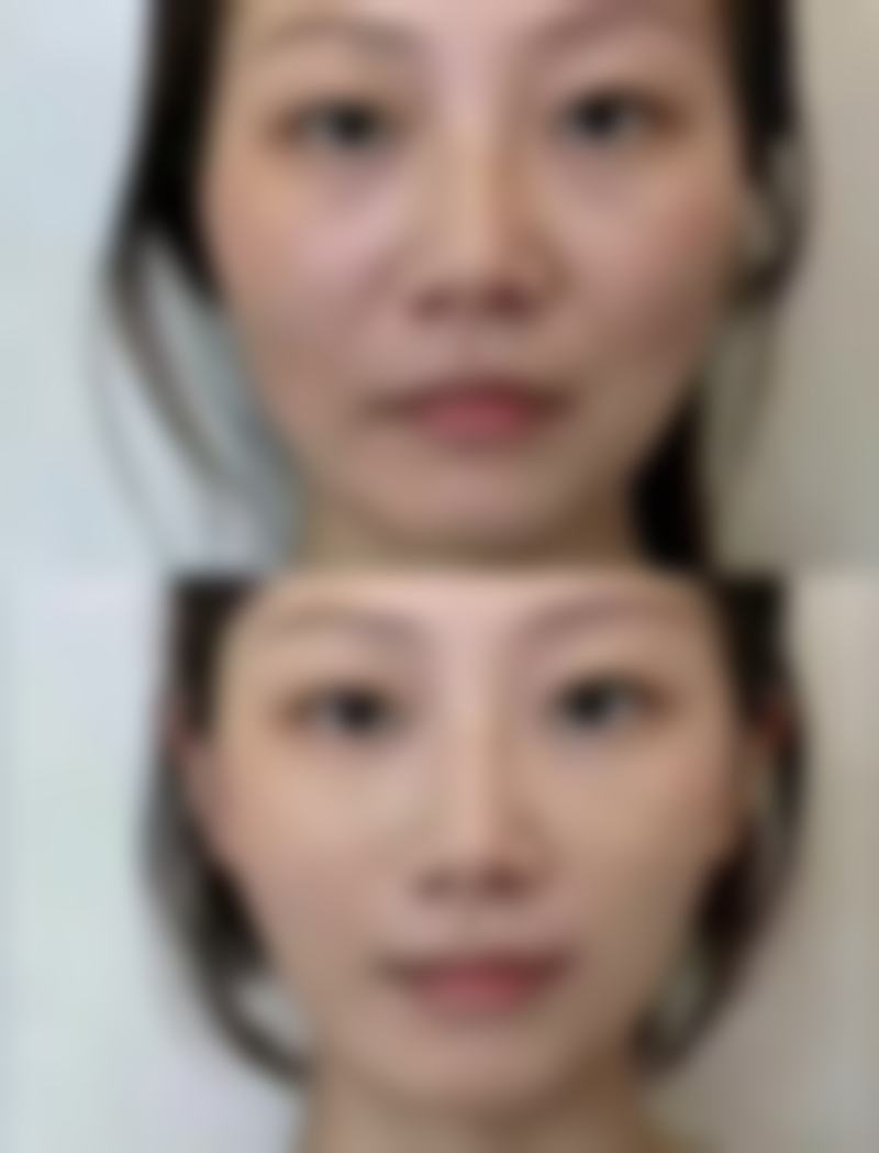 六、术后护理不可忽视