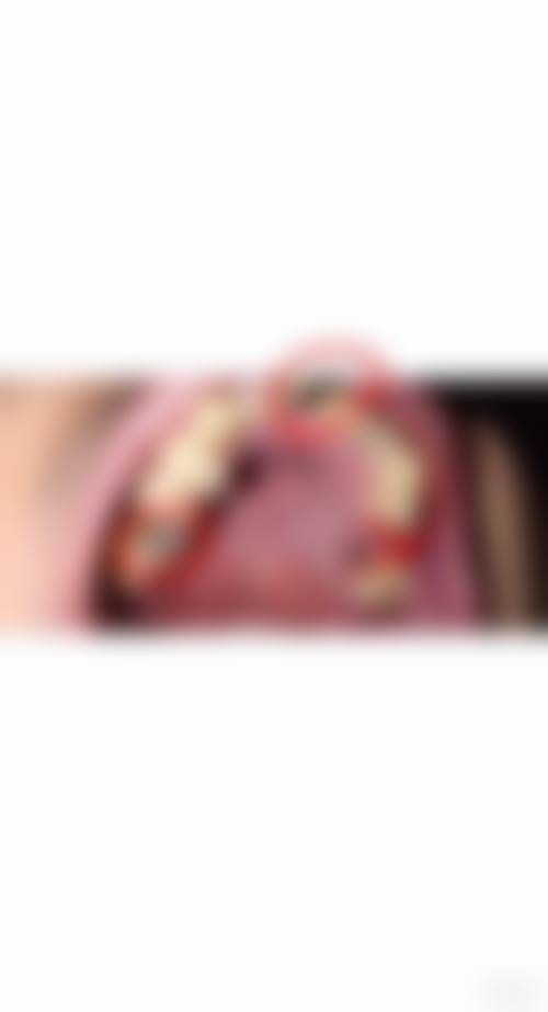 临床实例分享
