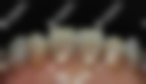 给牙齿一个专精的选择